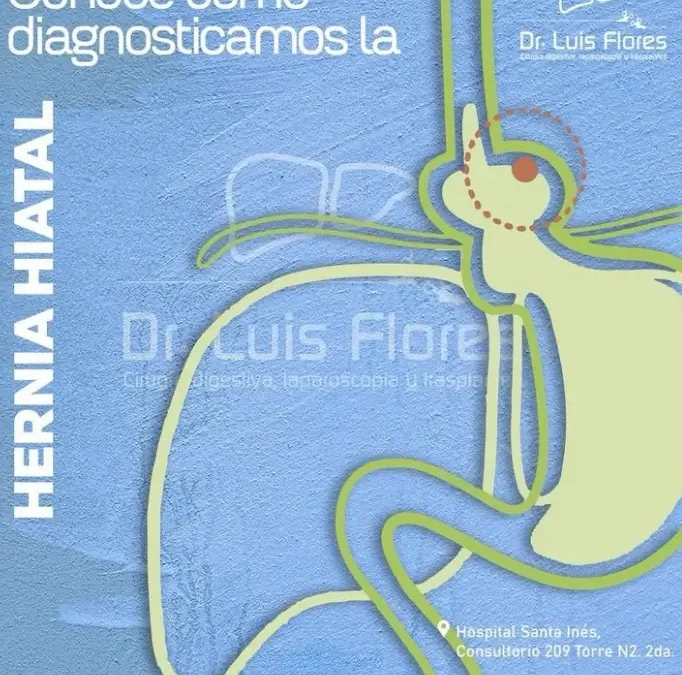 Cómo Diagnosticamos la Hernia Hiatal