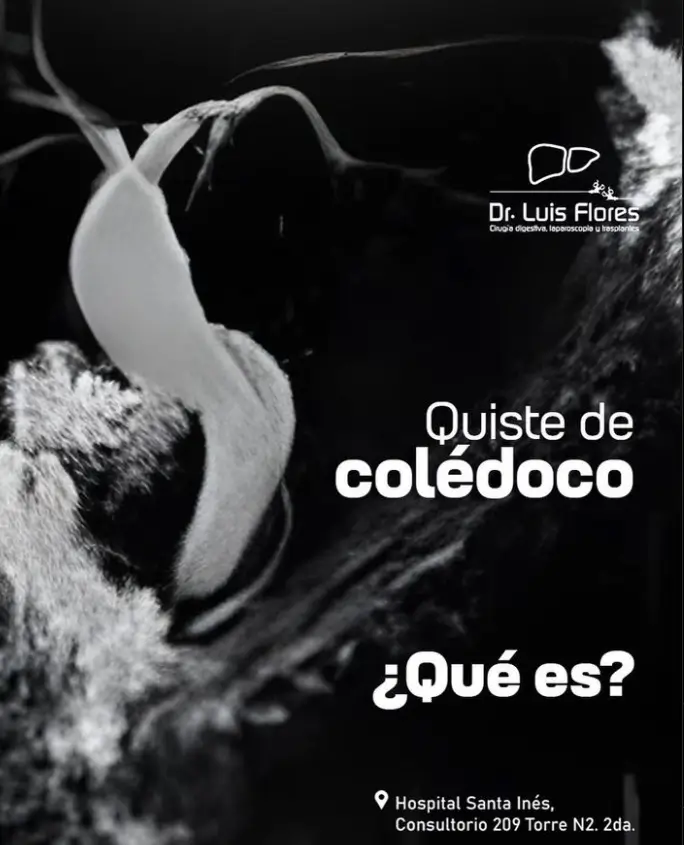 Quiste de colédoco - Dr. Luis Flores en la ciudad de Cuenca - Ecuador, Cirujano general y digestivo.
