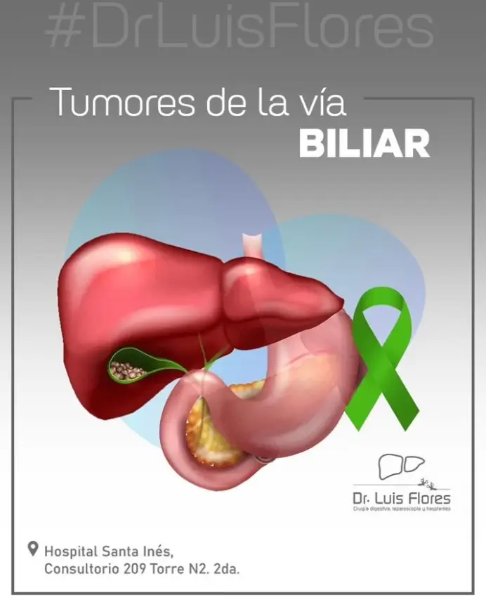 Information about bile duct tumors: types, symptoms, causes and treatments, explained by Dr. Luis Flores