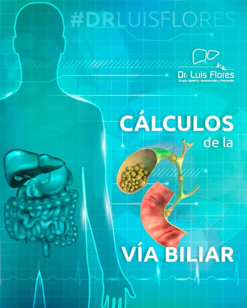 Cálculos, Dr. Flores en la ciudad de Cuenca, es un especialista en cirugía digestiva.