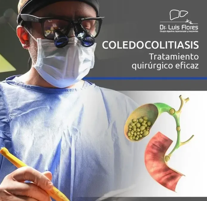 Coledocolitiasis en Pacientes con Enfermedades Hepáticas: Cuidados y Consideraciones Especiales