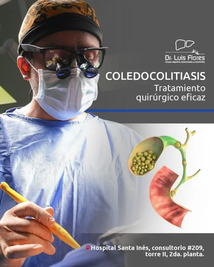 coledocolitiasis, Dr. Flores cirujano digestivo, y general en la ciudad de Cuenca - Ecuador.