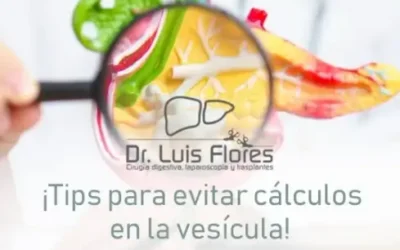 Guía para Mantener tu Vesícula Saludable