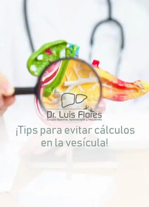 Guía para Mantener tu Vesícula Saludable