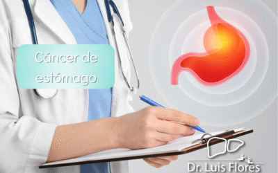 Cáncer de Estómago en Cuenca