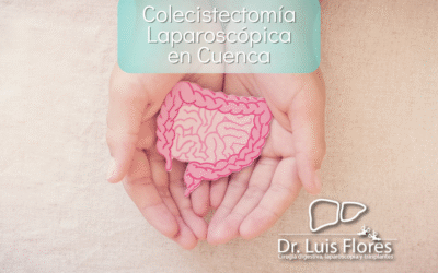 Colecistectomía Laparoscópica en Cuenca