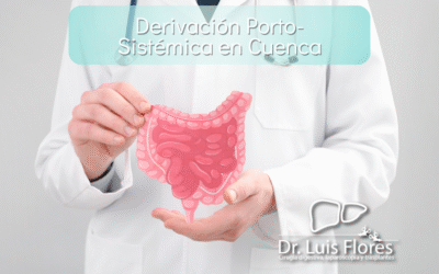 Derivación Porto-Sistémica en Cuenca