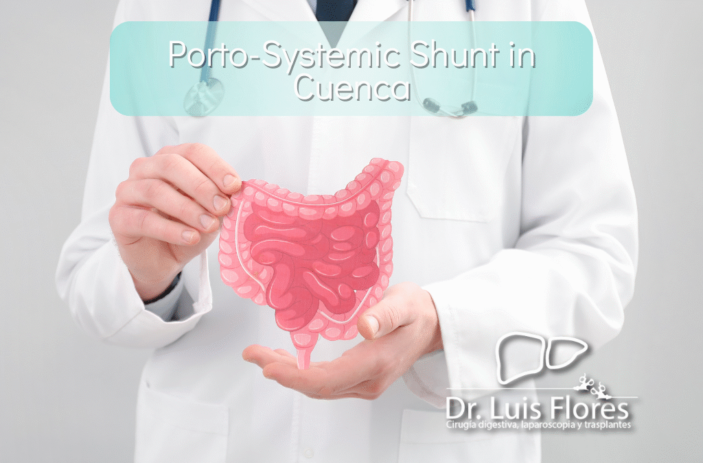 Porto-Systemic Shunt in Cuenca