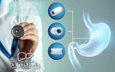 ¿Qué es una Colecistectomía Laparoscópica Detallada?