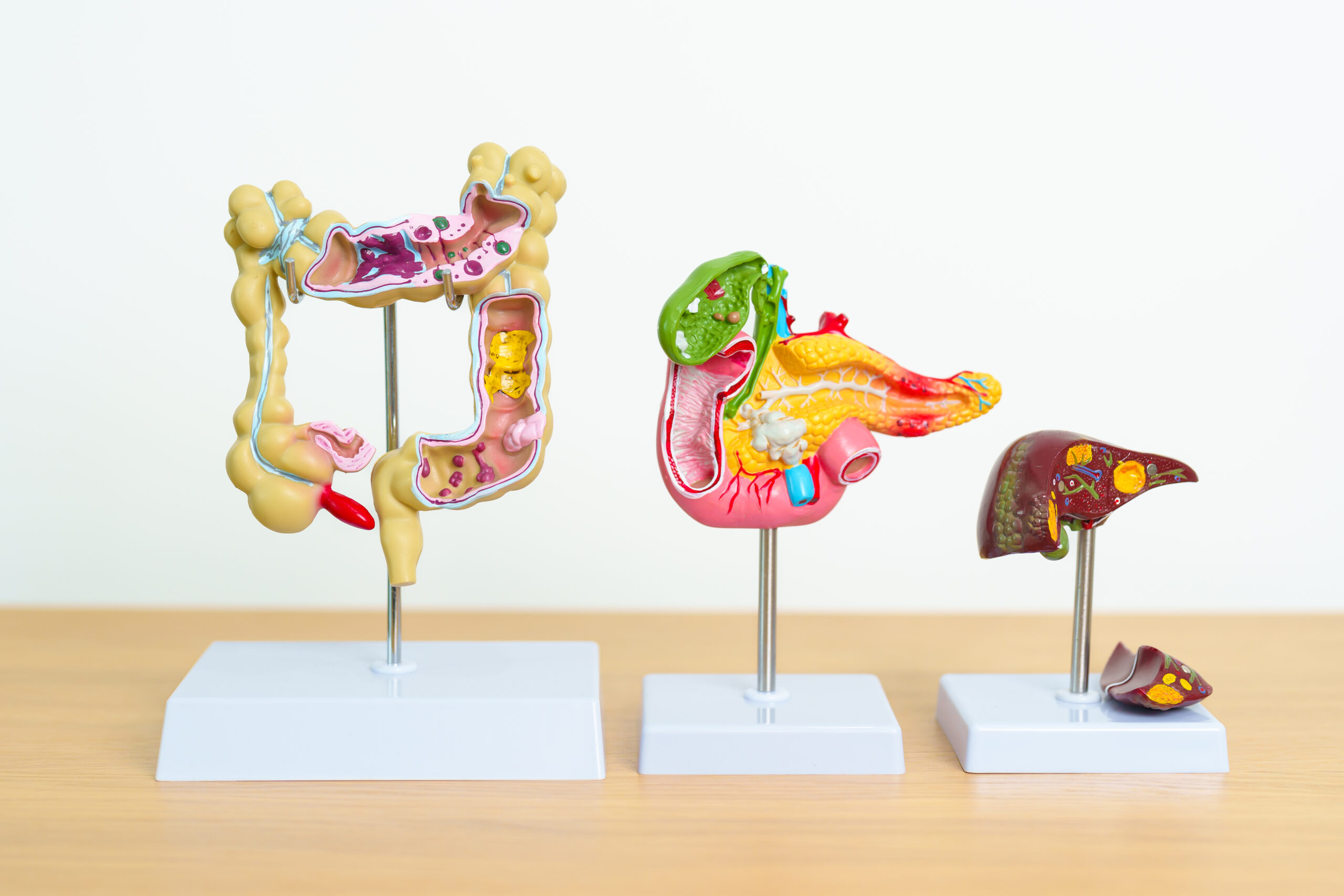 ¿Qué es la cirugía hepatobiliopancreática?
