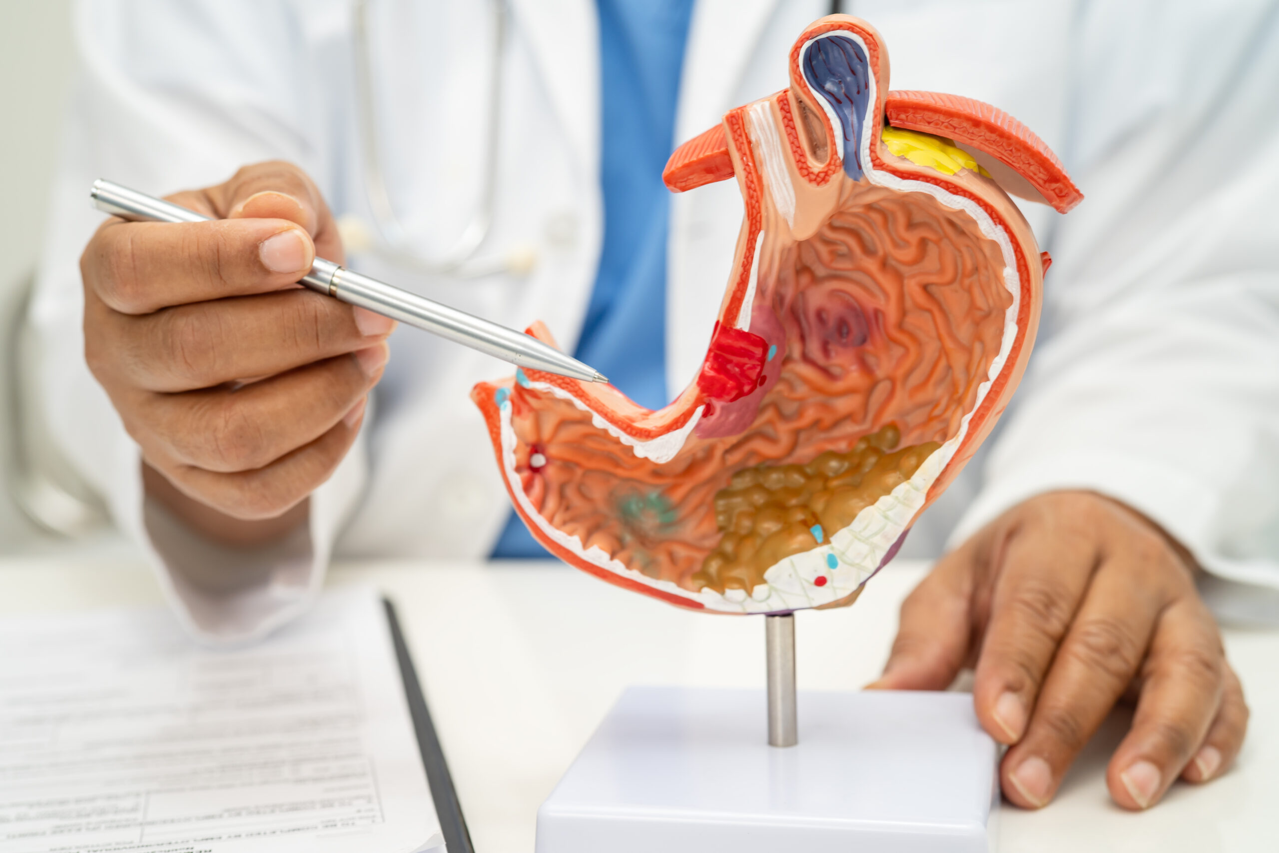¿Qué es la colecistectomía laparoscópica?