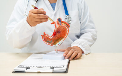 Cirugía Digestiva en Ecuador: Guía Completa de Procedimientos y Recuperación