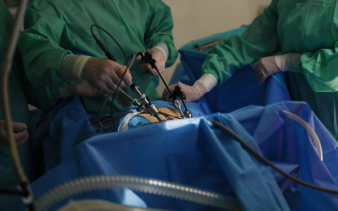 Laparoscopic Biliodigestive Bypass in Cuenca