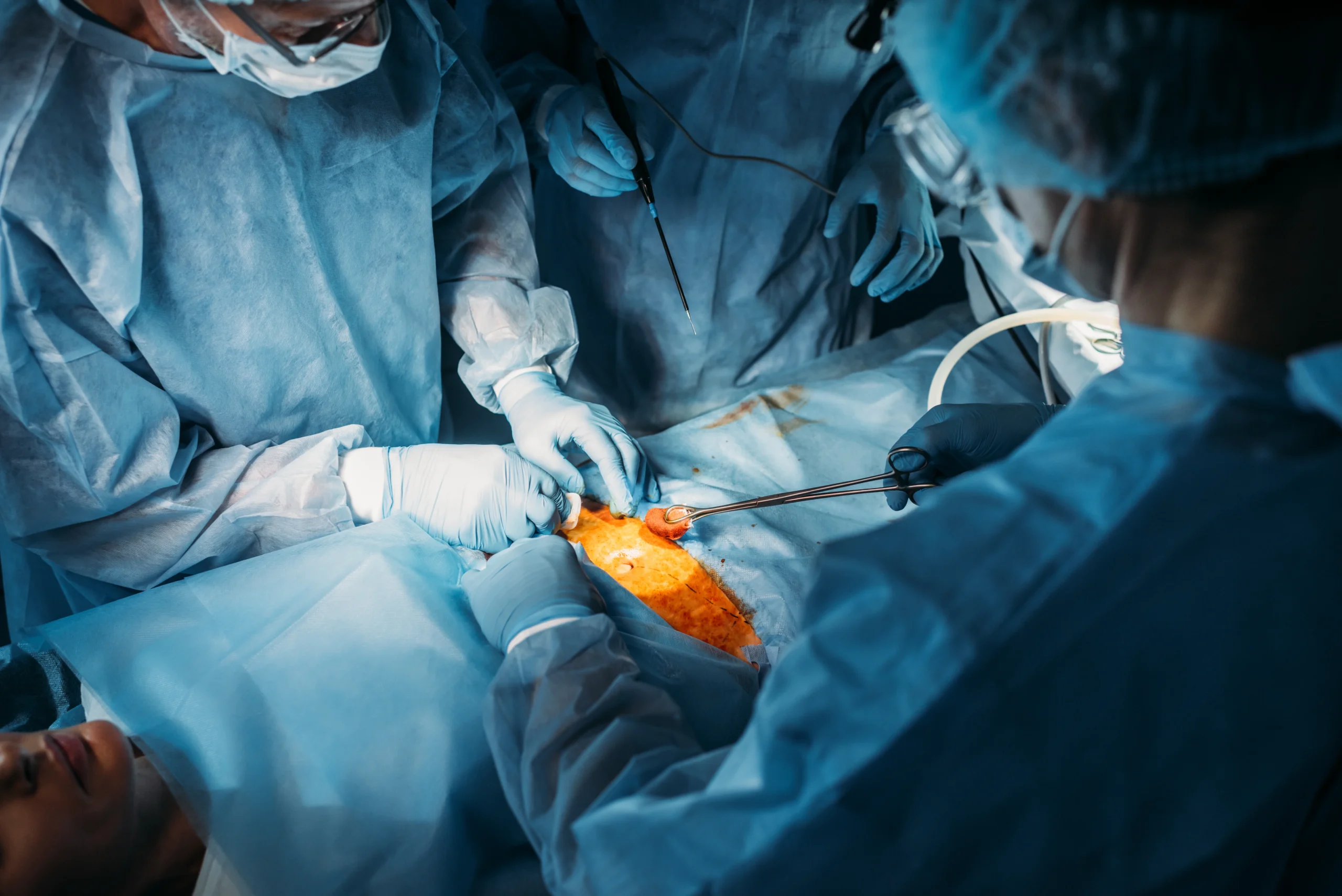 surgical-team-performing-a-medical-procedure-in-ho-2026-09-21-05-40-56-utc surgical-team-performing-a-medical-procedure-